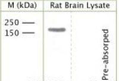 Western Blot: TrkC [p Tyr820] Antibody [NBP1-03448]